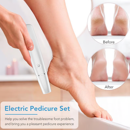 Hot Sale - 50% OFF Electric Feet Callus Remover