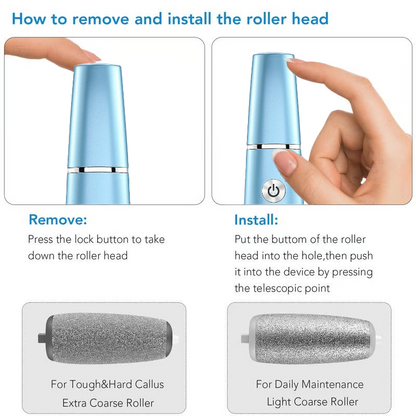 Hot Sale - 50% OFF Electric Feet Callus Remover