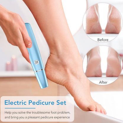 Hot Sale - 50% OFF Electric Feet Callus Remover