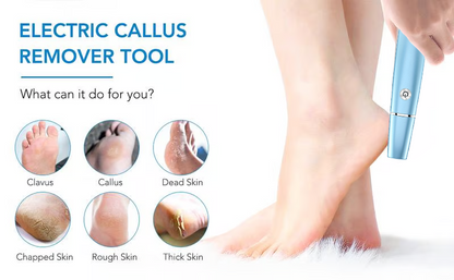 Hot Sale - 50% OFF Electric Feet Callus Remover