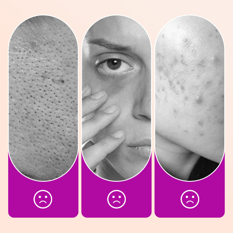 Buy 2 Get 1 Free Flawless Brightening Under Eye Concealer