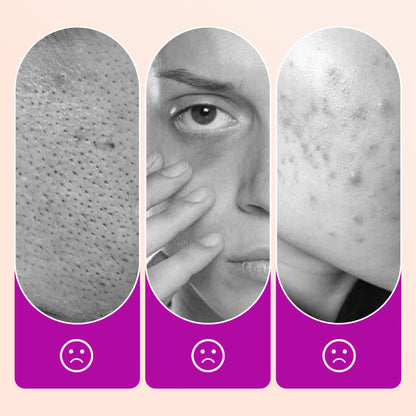 Buy 2 Get 1 Free Flawless Brightening Under Eye Concealer